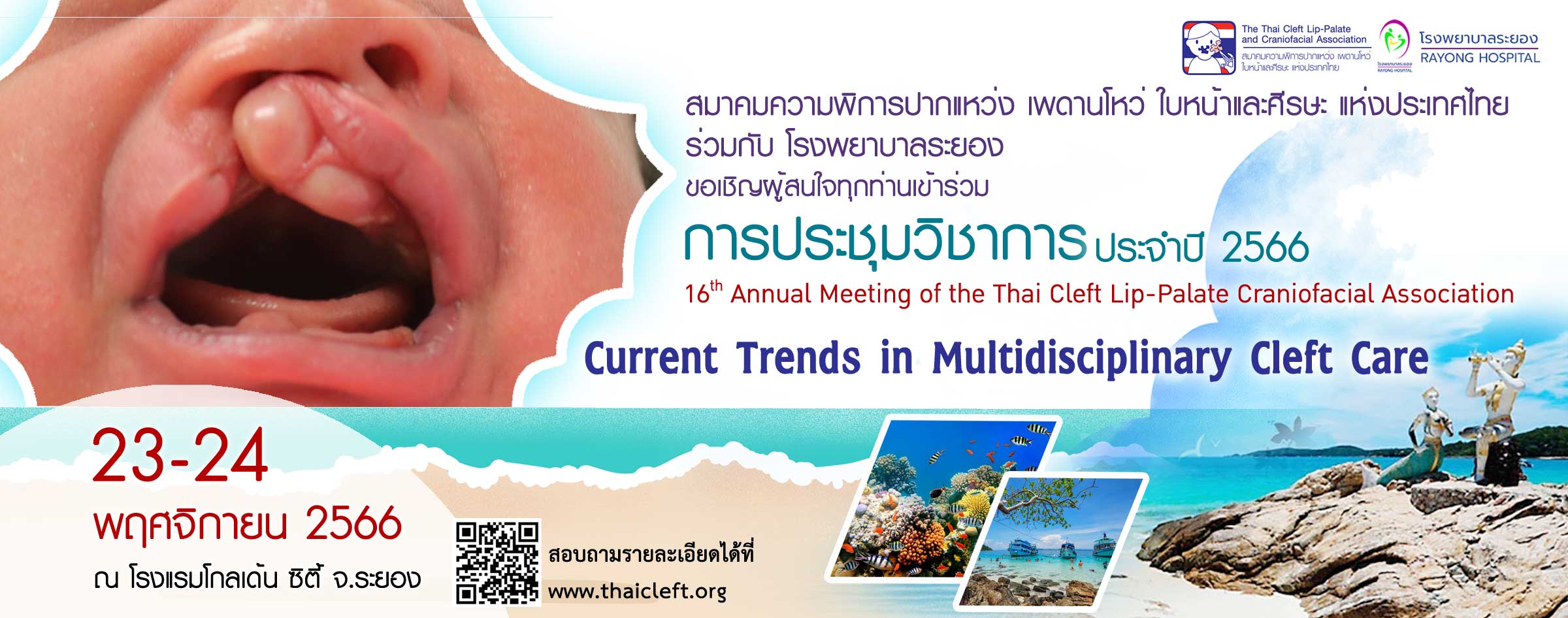 การประชุมวิชาการประจำปี 2566 ครั้งที่ 16 สมาคมความพิการปากแหว่ง เพดานโหว่ ใบหน้าและศีรษะ แห่งประเทศไทย