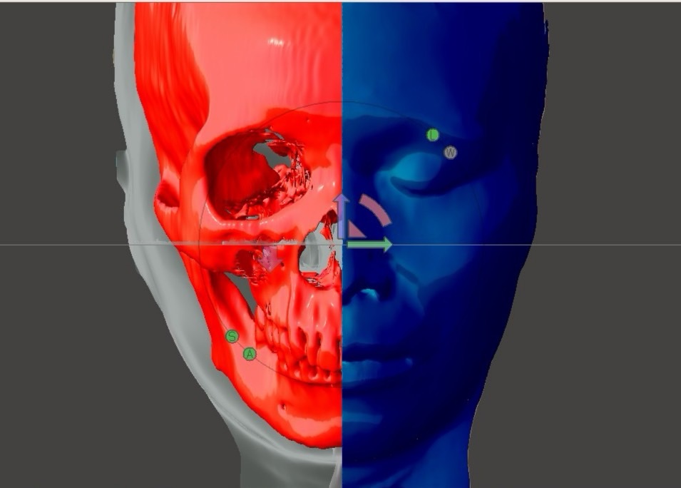 3D printing